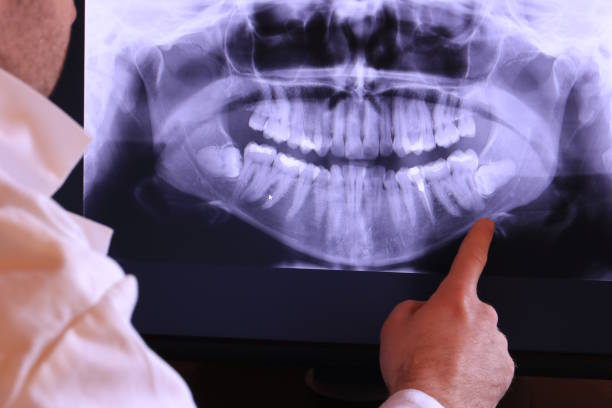 Best Urgent Care for Lost Fillings or Crowns in Amberley, OH